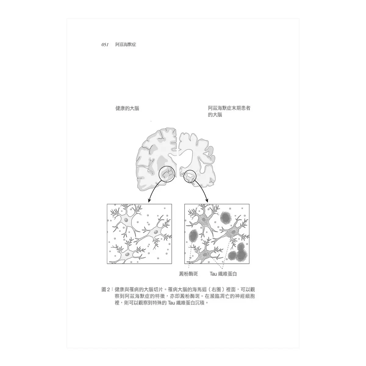 失智可以預防，更可以治癒【暢銷改版】