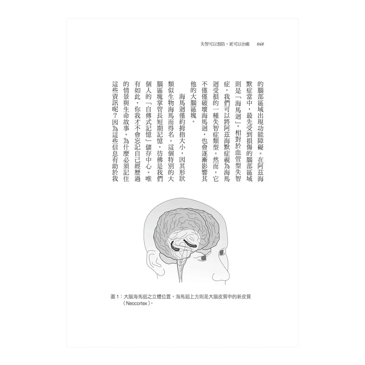 失智可以預防，更可以治癒【暢銷改版】