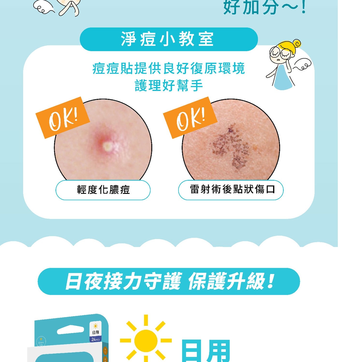 Derma Angel 護妍天使隱形痘痘貼日用包，0.01cm超薄邊服貼升級，全程隱形你的痘痘，霧面裸妝感，一貼就隱形，新一代水膠體，加強吸收。黏性適中，撕除無痛感，隔絕外部髒汙，全天候保護。