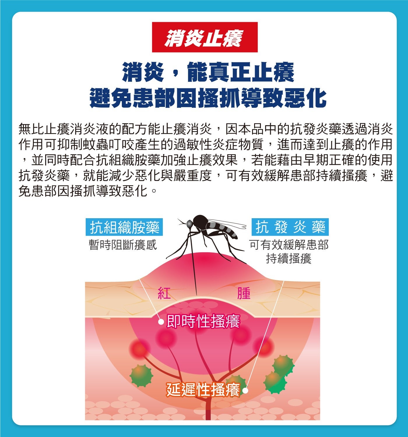 消炎止癢消炎,能真正止癢避免患部因搔抓導致惡化無比止癢消炎液的配方能止癢消炎,因本品中的抗發炎藥透過消炎作用可抑制蚊蟲叮咬產生的過敏性炎症物質,進而達到止癢的作用 ,並同時配合抗組織胺藥加強止癢效果,若能藉由早期正確的使用抗發炎藥...