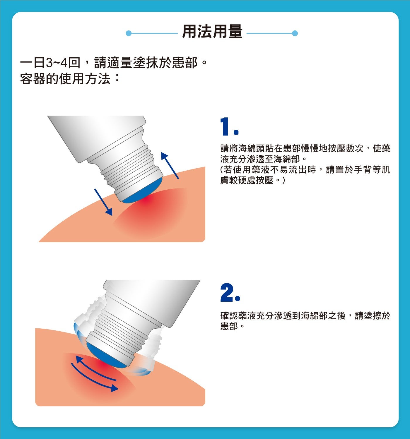 用法用量一日3~4回,請適量塗抹於患部容器的使用方法: 請將海綿頭貼在患部慢慢地按壓數次,使藥液充分滲透至海綿部若使用藥液不易流出時,請置於手背等肌膚較硬處按壓確認藥液充分滲透到海綿部之後,請塗擦於患部