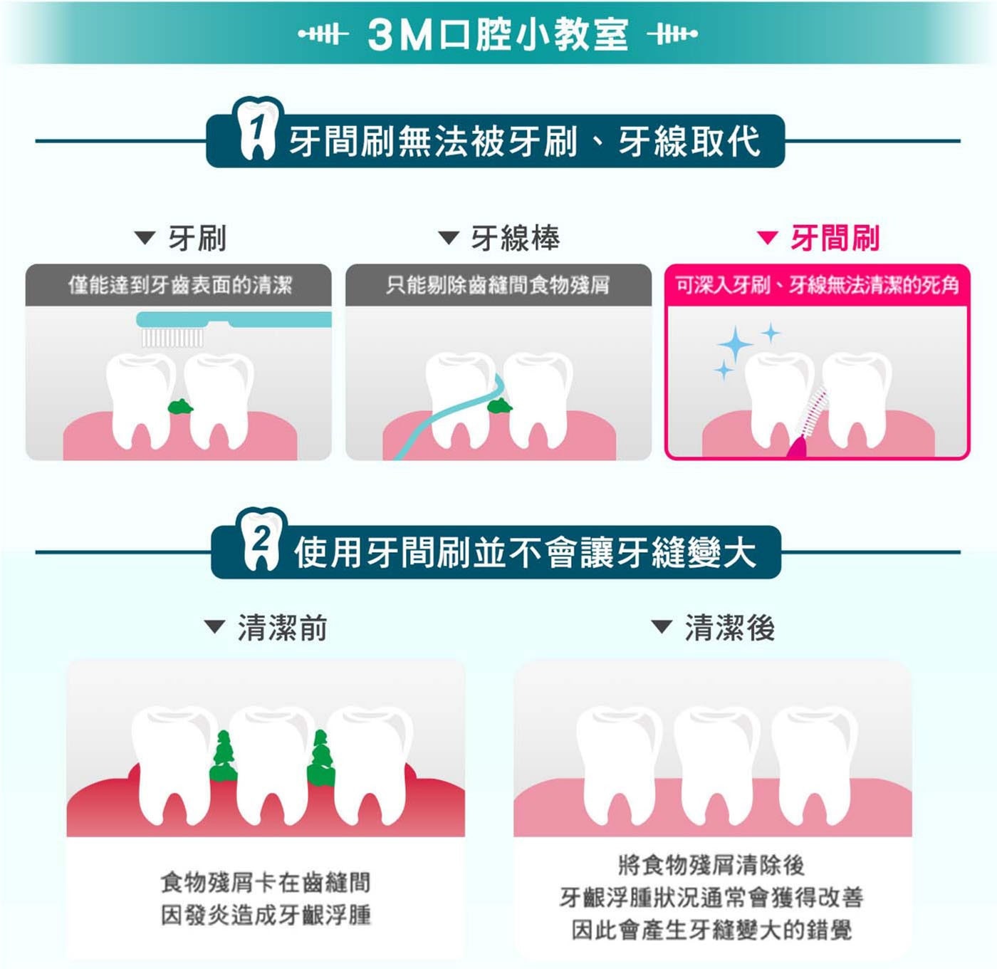 3M 護牙牙間刷 L型 144支