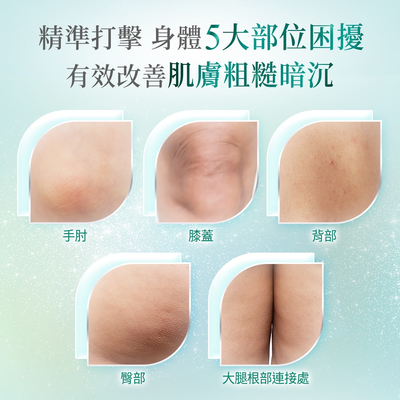 凡士林果酸煥膚精華身體乳465毫升5. 益生元修護精華注入，促進皮膚生態平衡