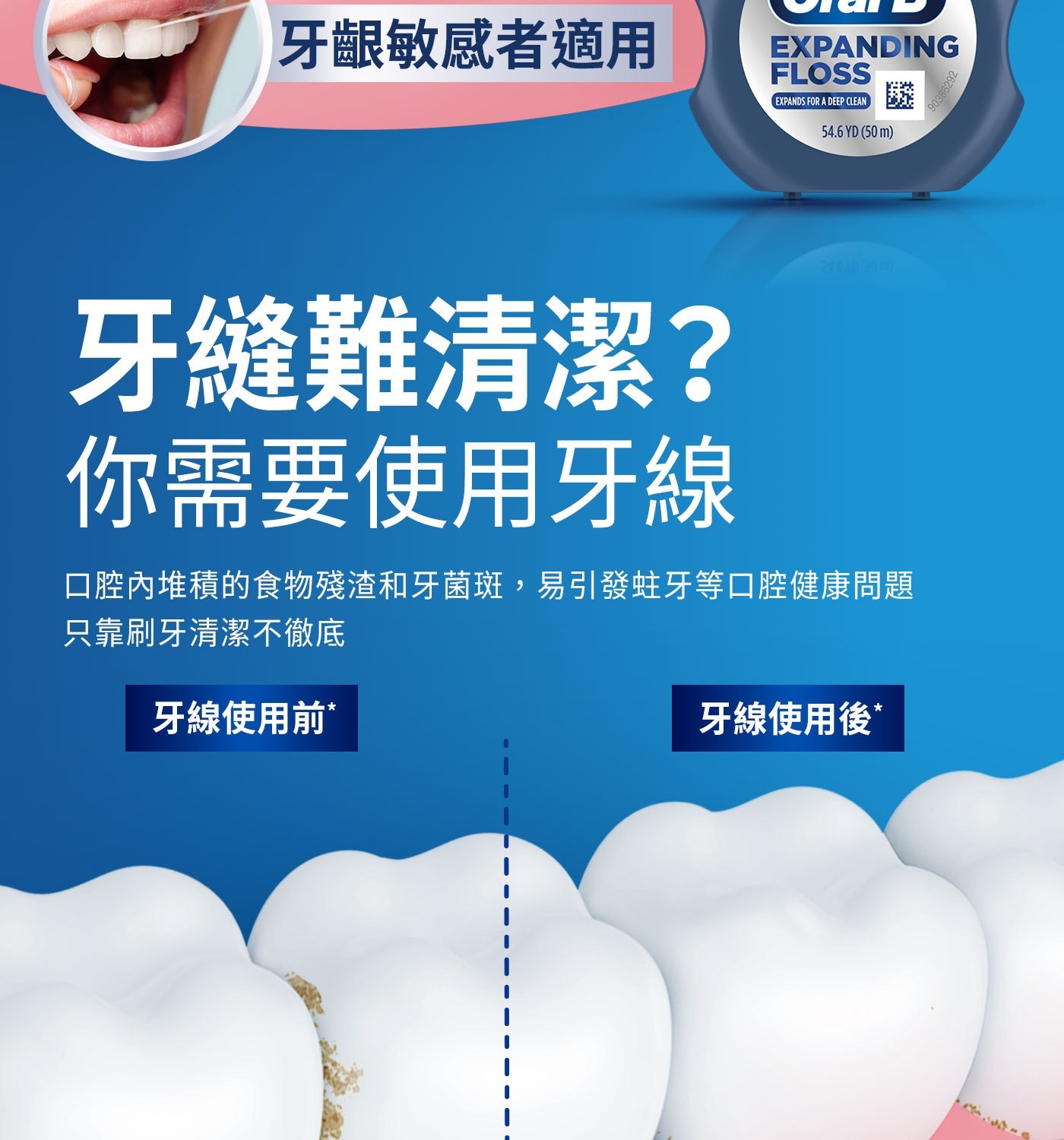 牙縫難清潔? 你需要使用牙線 口腔內堆積的食物殘渣和牙菌斑,易引發蛀牙等口腔健康問題 只靠刷牙清潔不徹底