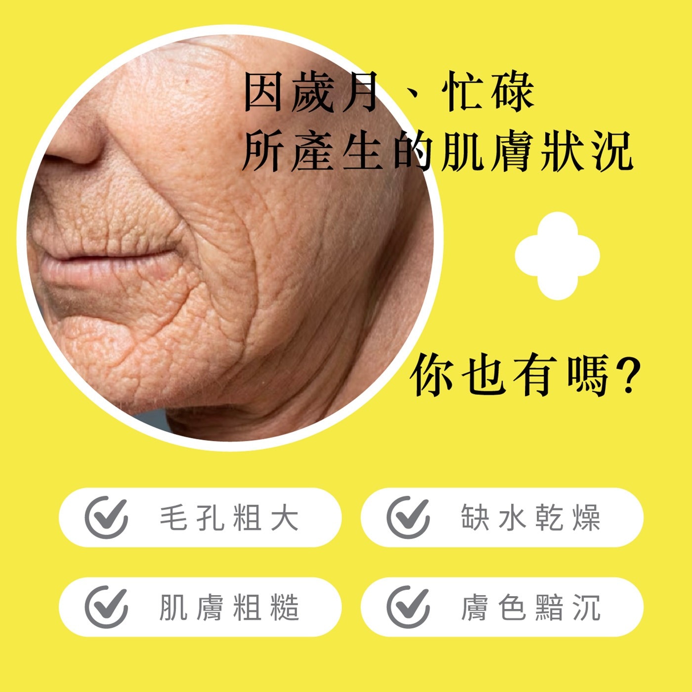 R 因歲月、忙碌 所產生的肌膚狀況 你也有嗎? 毛孔粗大 缺水乾燥 肌膚粗糙 ♡ 膚色黯沉