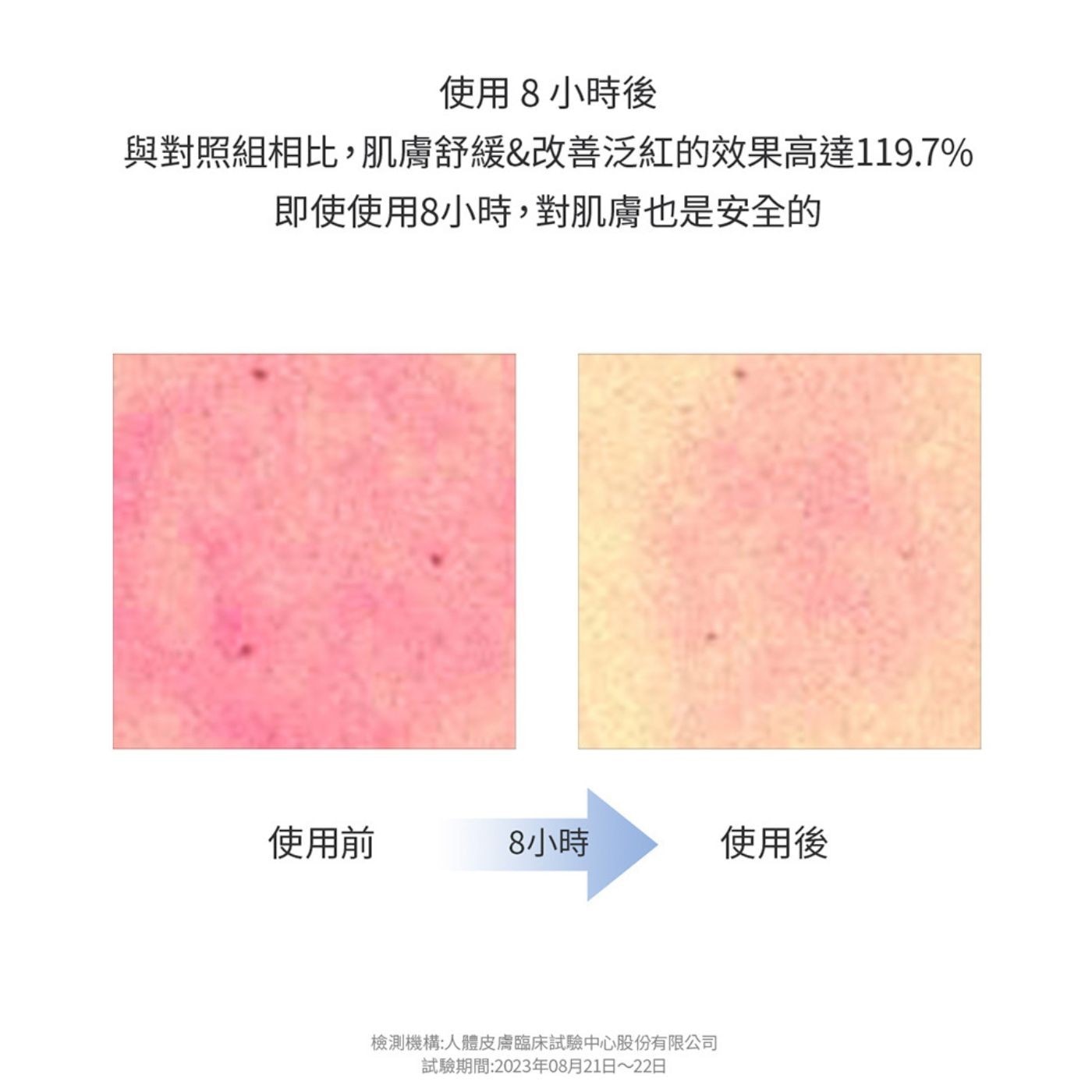 使用8小時後 與對照組相比,肌膚舒緩&改善泛紅的效果高達119.7% 即使使用8小時,對肌膚也是安全的
