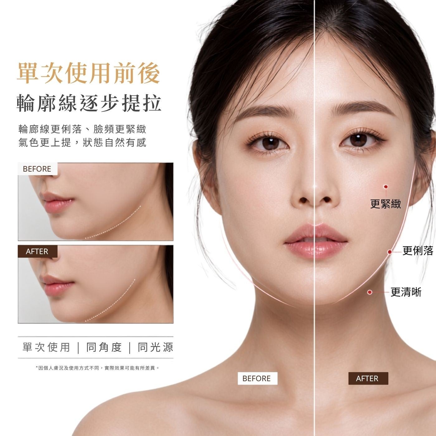 單次使用前後輪廓線逐步提拉輪廓線更俐落、臉頻更緊緻氣色更上提,狀態自然有感單次使用同角度同光源因個人膚況及使用方式不同,實際效果可能有所差異更緊緻更俐落 -更清晰
