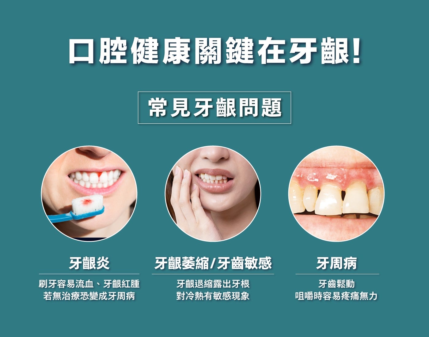 口腔健康關鍵在牙齦! 常見牙齦問題牙齦炎牙齦萎縮/牙齒敏感牙周病刷牙容易流血、牙齦紅腫若無治療恐變成牙周病牙齦退縮露出牙根對冷熱有敏感現象牙齒鬆動咀嚼時容易疼痛無力