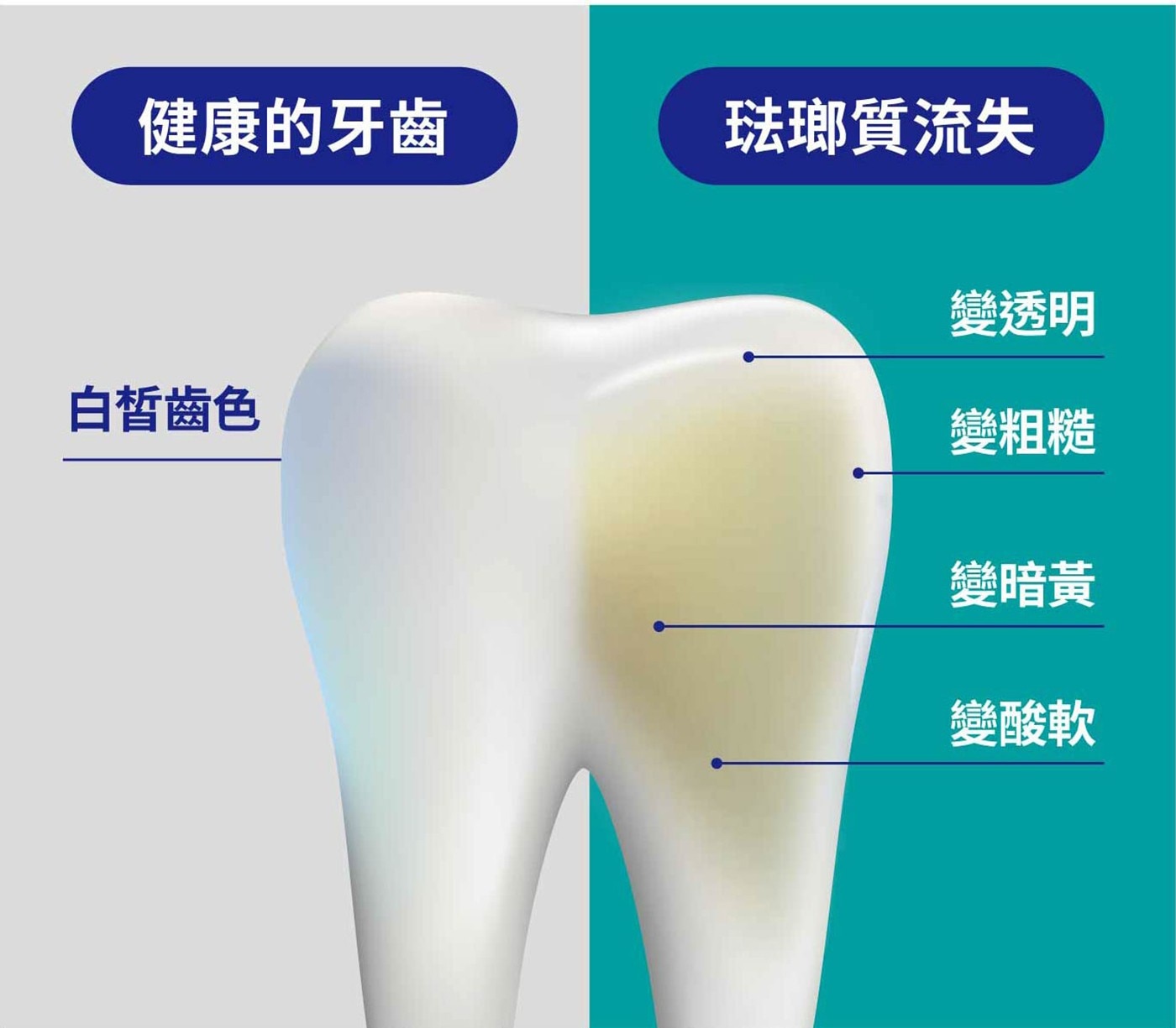 舒酸定 強健琺瑯質多效牙膏130公克 X 6入 幫助牙齒對抗日常酸蝕+避免琺瑯質流失