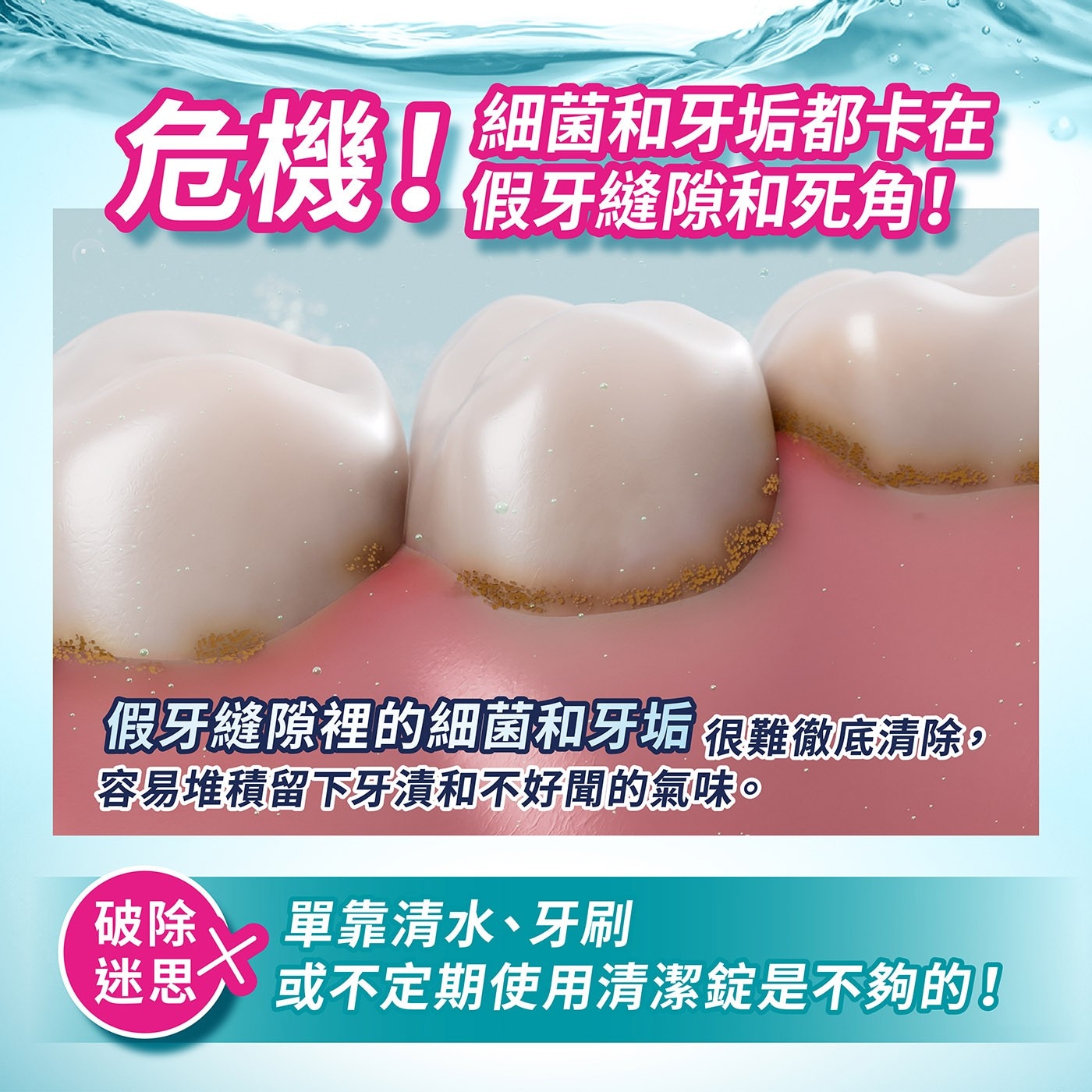 危機!細菌和牙垢都卡在假牙縫隙和死角!