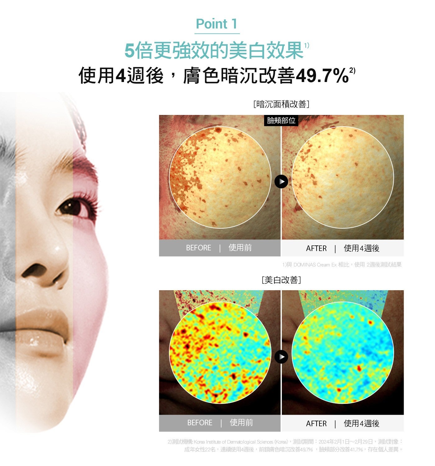 Point 5 倍更強效的美白效果 使用 4 週後,膚色暗沉改善 49.