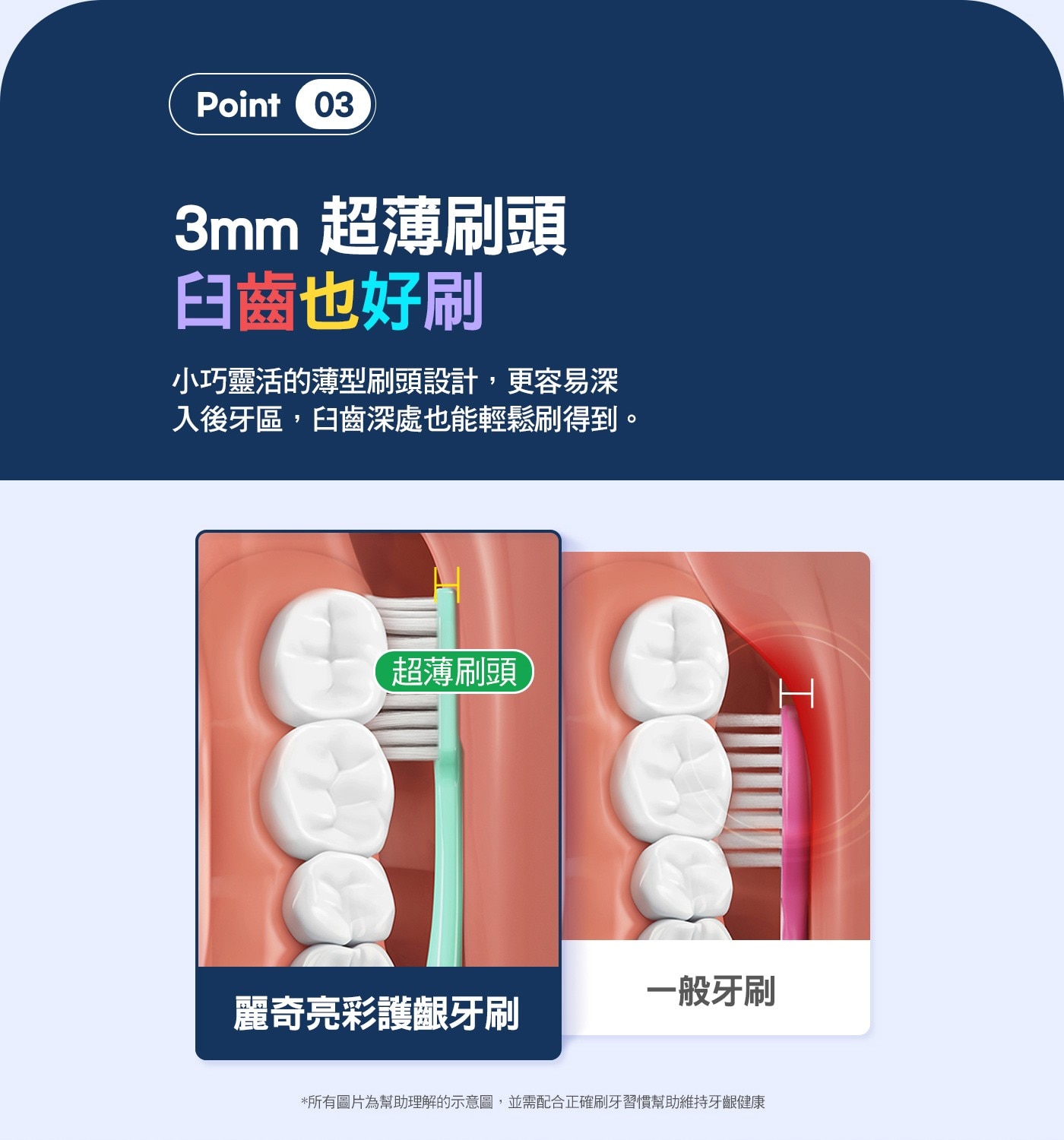 3mm 超薄刷頭 臼齒也好刷 小巧靈活的薄型刷頭設計,更容易深 入後牙區,臼齒深處也能輕鬆刷得到。